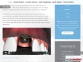 Dental Implants Glasgow